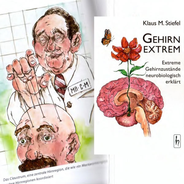 Gehirn extrem